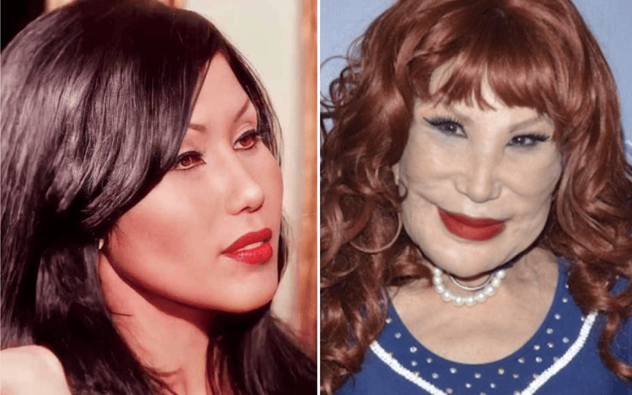 Arriba el Botox! Lyn May recomienda a las mujeres hacerse arreglos estéticos para sentirse bonitas