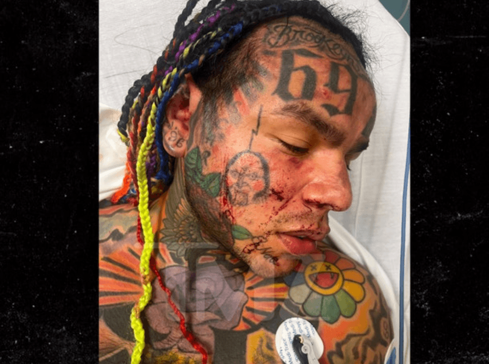 Tekashi 6IX9ine fue golpeado en un gimnasio 