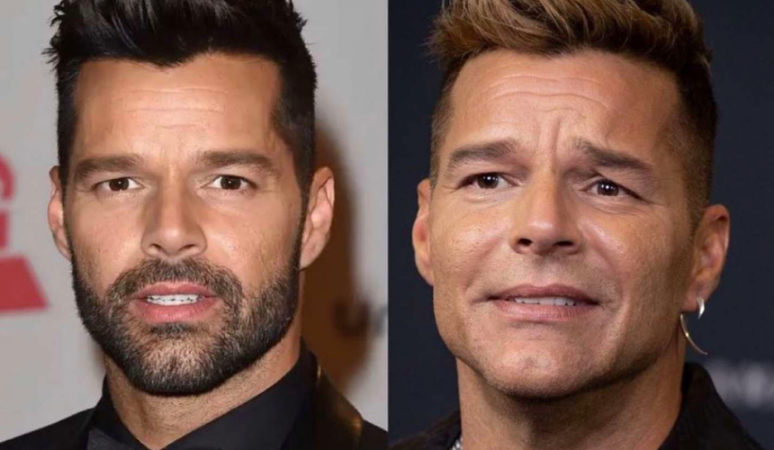 ricky martin cambio de rostro irreconocible