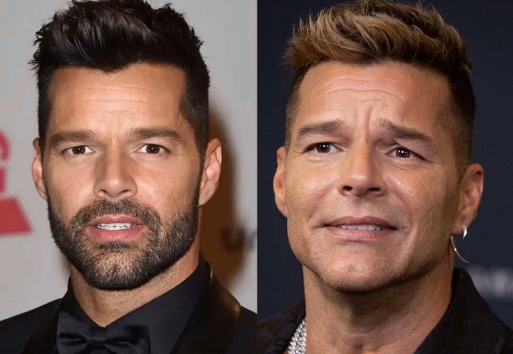 ricky martin cambio de rostro irreconocible